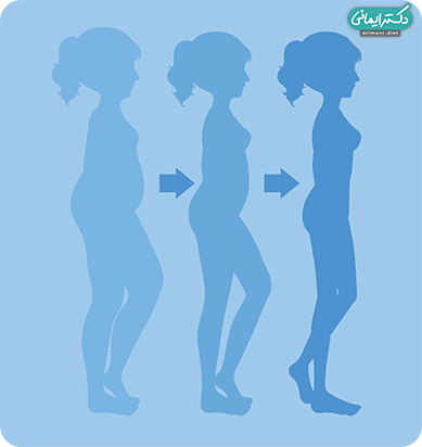 کاهش وزن چونه اتفاق میافتد؟ کاهش وزن چگونه اتفاق میافتد؟